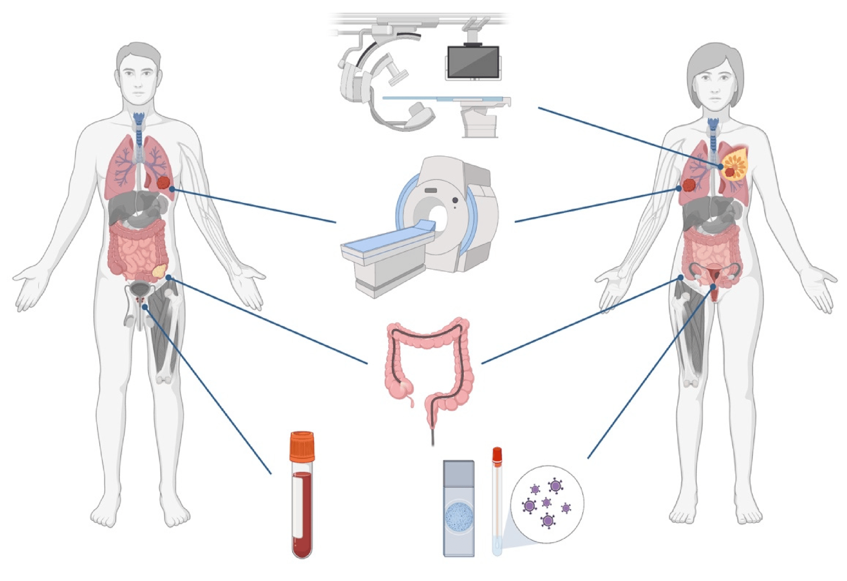 POTENTIAL OF BLOOD-BASED TESTS FOR CANCER SCREENING - UPSC