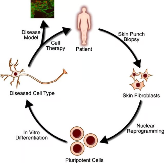 Scientists Use Stem Cells to Reverse Diabetes