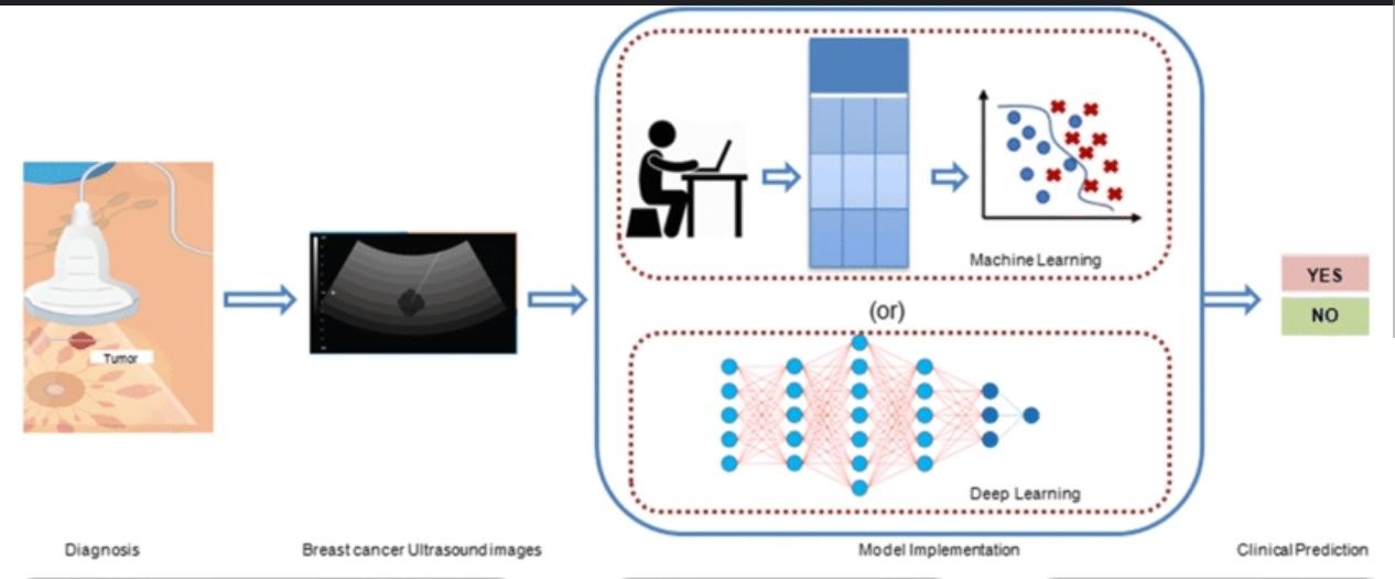 Revolutionizing Cancer Detection: Ultrasound-Based Diagnostics