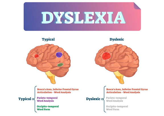 India Illuminates Landmarks to Raise Dyslexia Awareness Nationwide