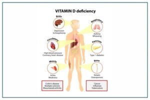 Rising Health Risks from Vitamin D Deficiency