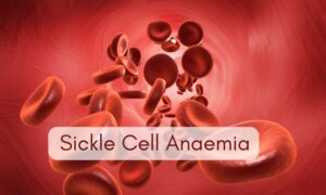 India Screens 6 Crore People for SC Disease