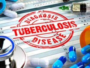 India’s Challenge: TB Elimination by 2025