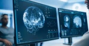 SCAN Brain Discovery Parkinson's Hope