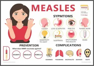 Bangladesh Measles Crisis 2026