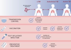 India's 5 Pathways to Eliminate Tuberculosis
