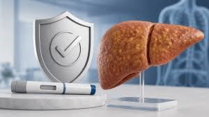 CDSCO Approves Wegovy for MASH Fatty Liver Disease