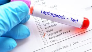 Kerala leptospirosis burden