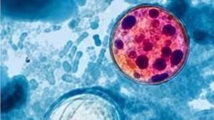 Michigan Reports First U.S. Cyclosporiasis Deaths